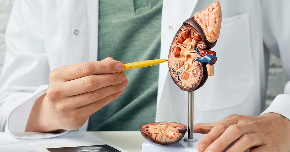 The Threat of Kidney Stones to Kidney Health and Function The Threat of Kidney Stones to Kidney Health and Function