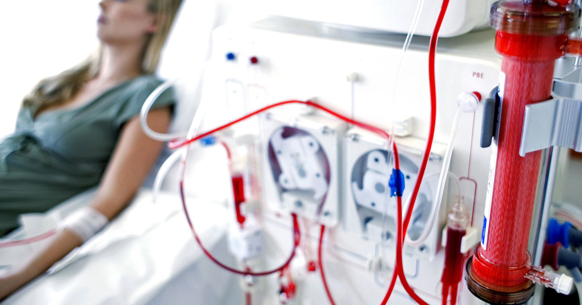 Understanding Dialysis and Strategies to Delay its Onset for Preserving Kidney Function