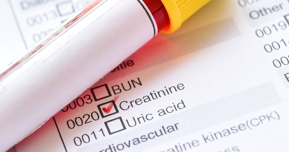Still Looking at Creatinine Level For Kidney Function?