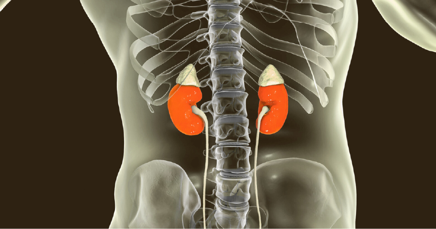 Why Your Kidneys Need Extra Care and Support